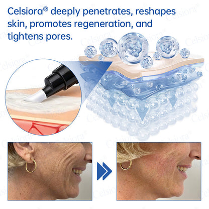 Celsiora® PDRN Anti-Wrinkle Shot – Lift & Firming Cream