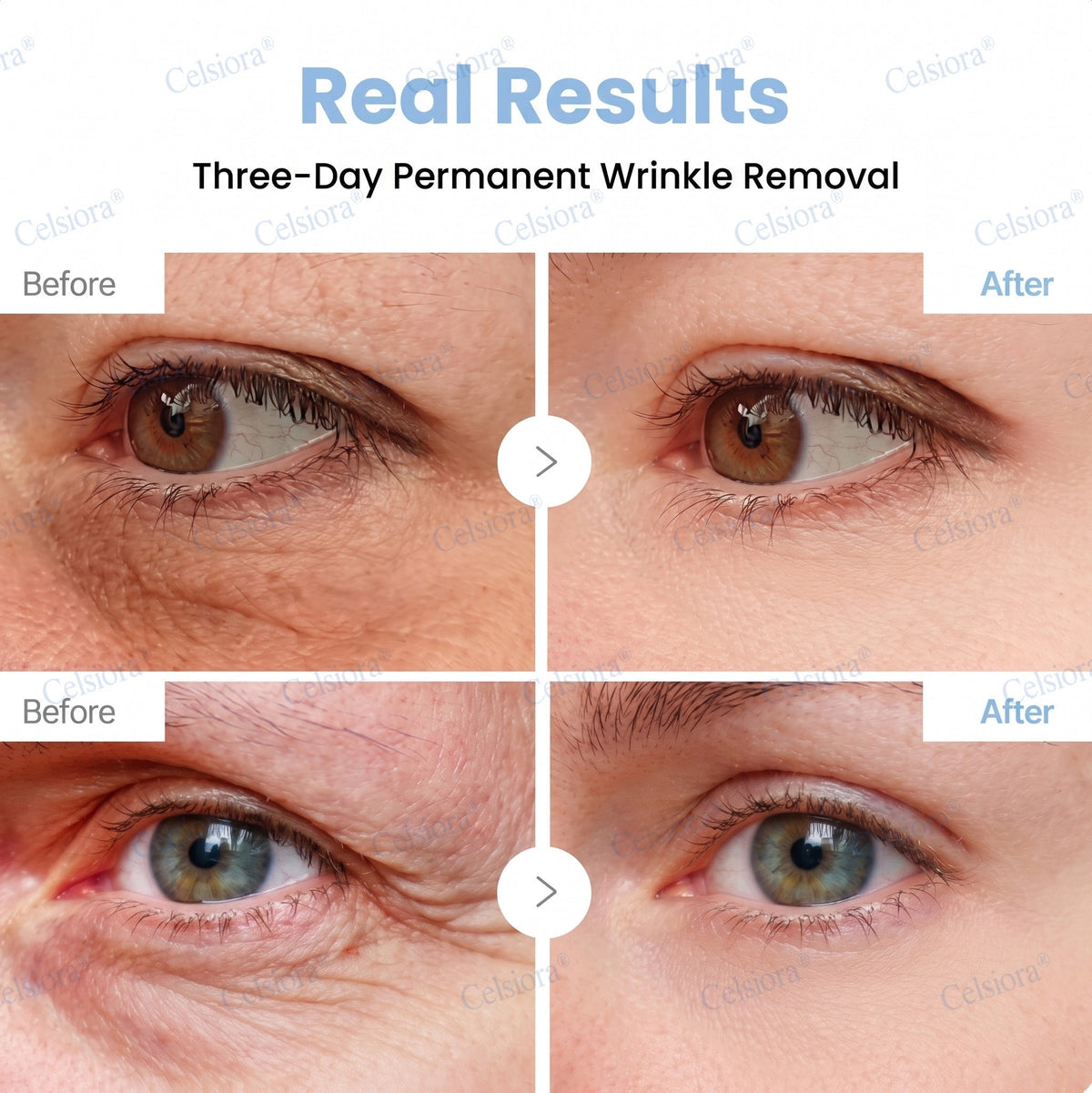 Celsiora® PDRN Anti-Wrinkle Shot – Lift & Firming Cream