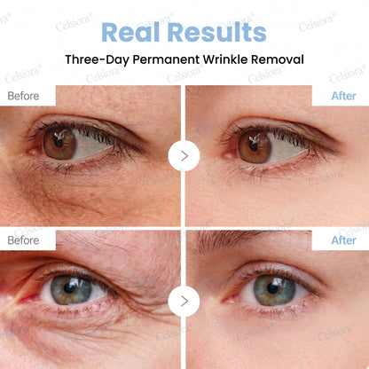 Celsiora® PDRN Anti-Wrinkle Shot – Lift & Firming Cream