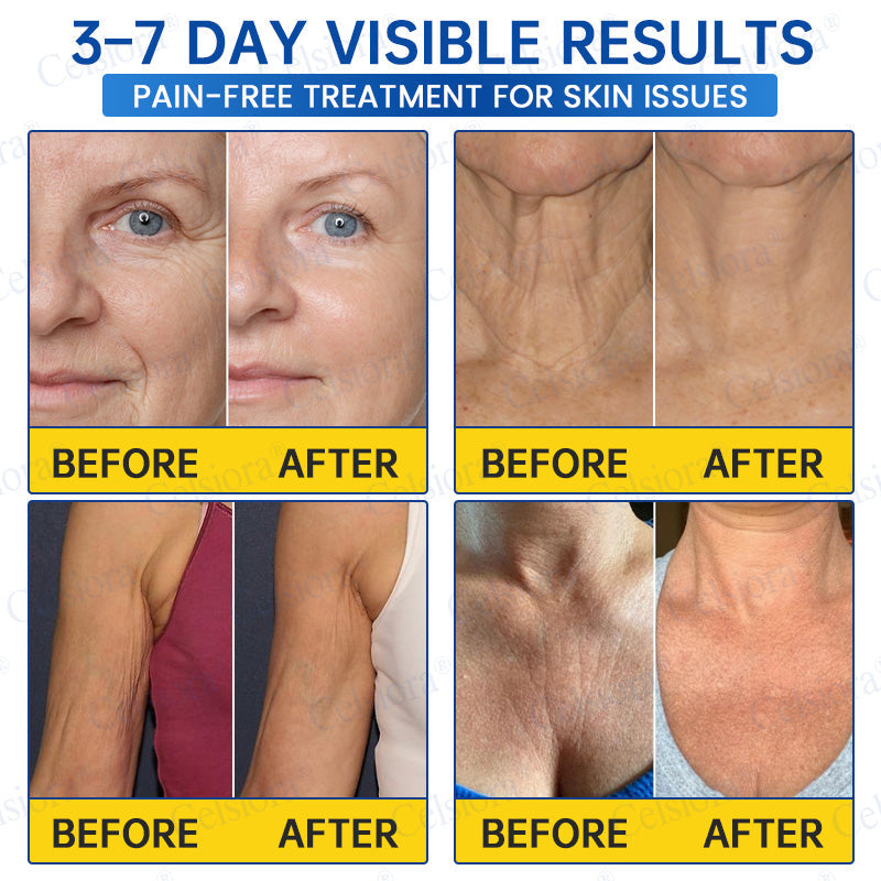 Celsiora® PDRN Anti-Wrinkle Shot – Lift & Firming Cream