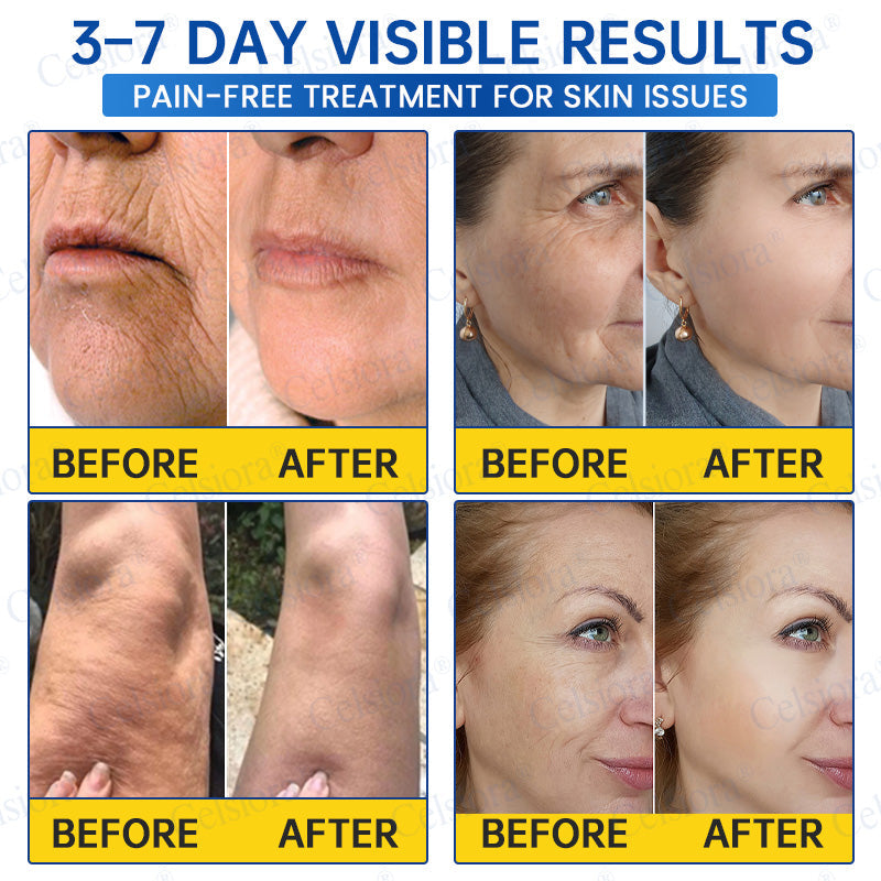 Celsiora® PDRN Anti-Wrinkle Shot – Lift & Firming Cream