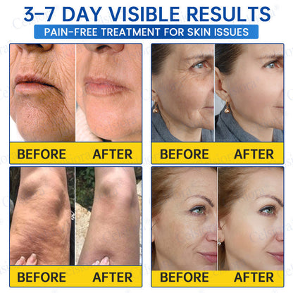 Celsiora® PDRN Anti-Wrinkle Shot – Lift & Firming Cream