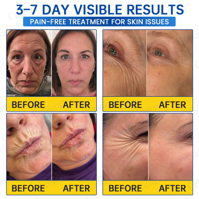 Celsiora® PDRN Anti-Wrinkle Shot – Lift & Firming Cream