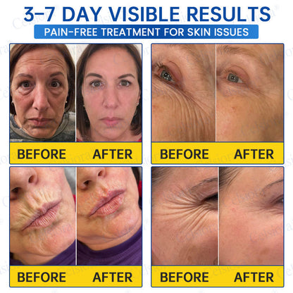 Celsiora® PDRN Anti-Wrinkle Shot – Lift & Firming Cream